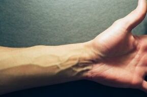 hand