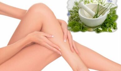 Treatment of varicose veins of the lower extremities with folk remedies