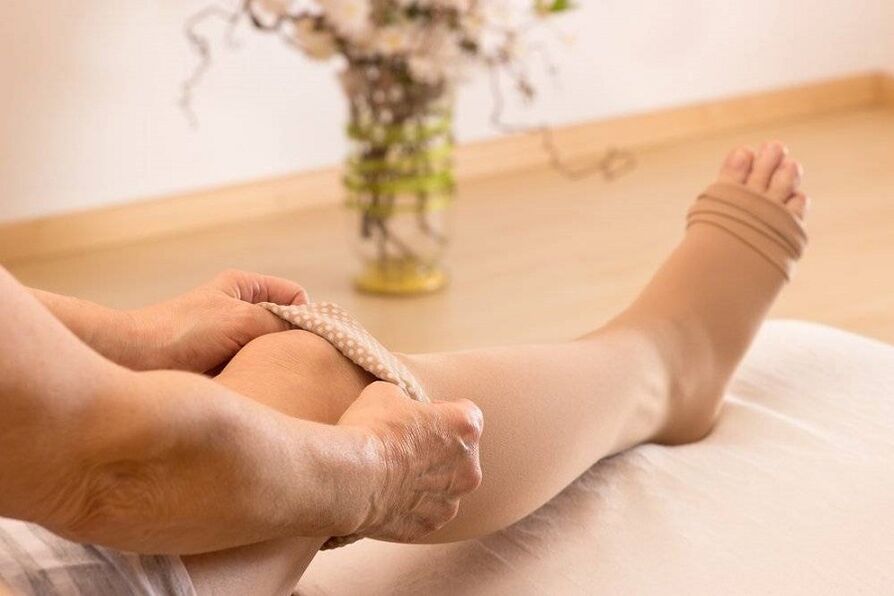 compression stockings for varicose veins
