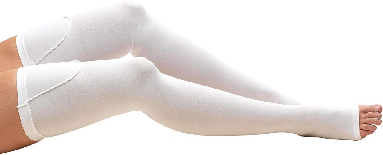 To treat varicose veins, you need to wear compression stockings